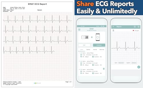 Portable ECG Monitor