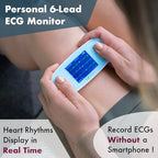 Portable ECG Monitor