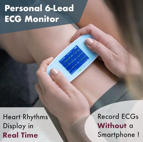 Portable ECG Monitor