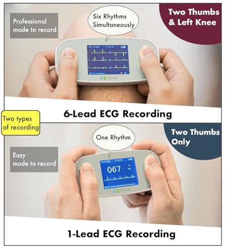 Portable ECG Monitor