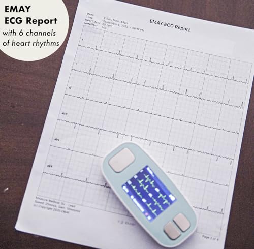 Portable ECG Monitor