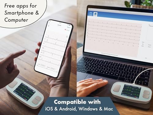 Portable ECG Monitor