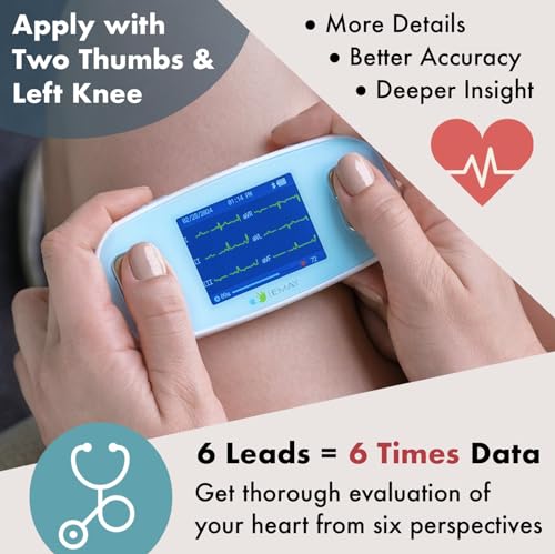 Portable ECG Monitor