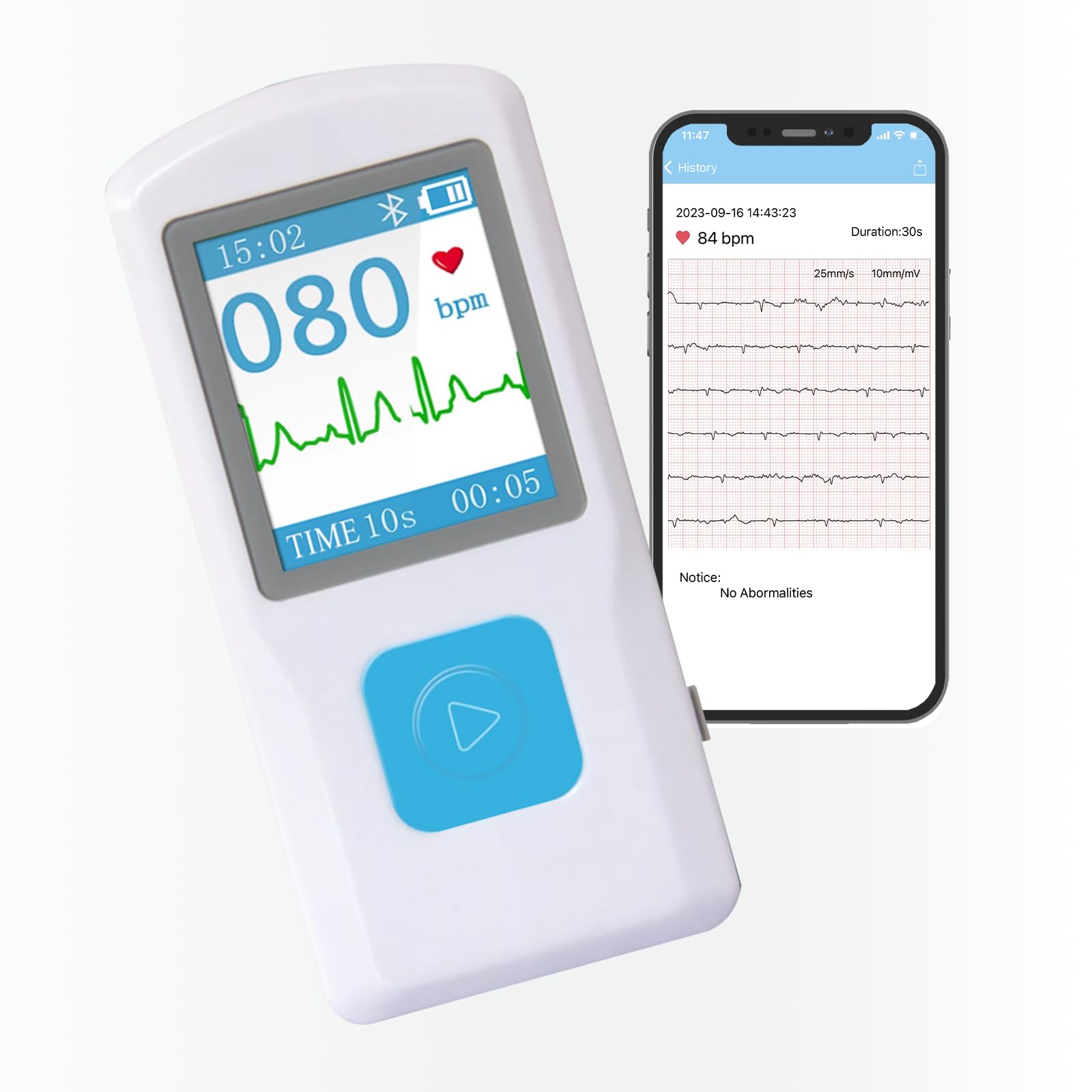 Portable EKG Monitor