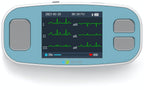 Portable ECG Monitor
