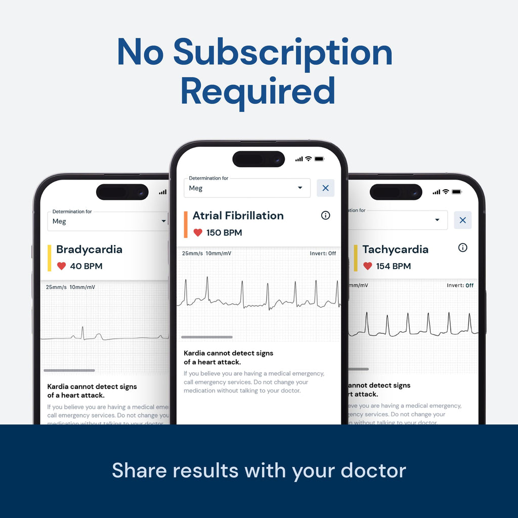 Personal EKG Monitor