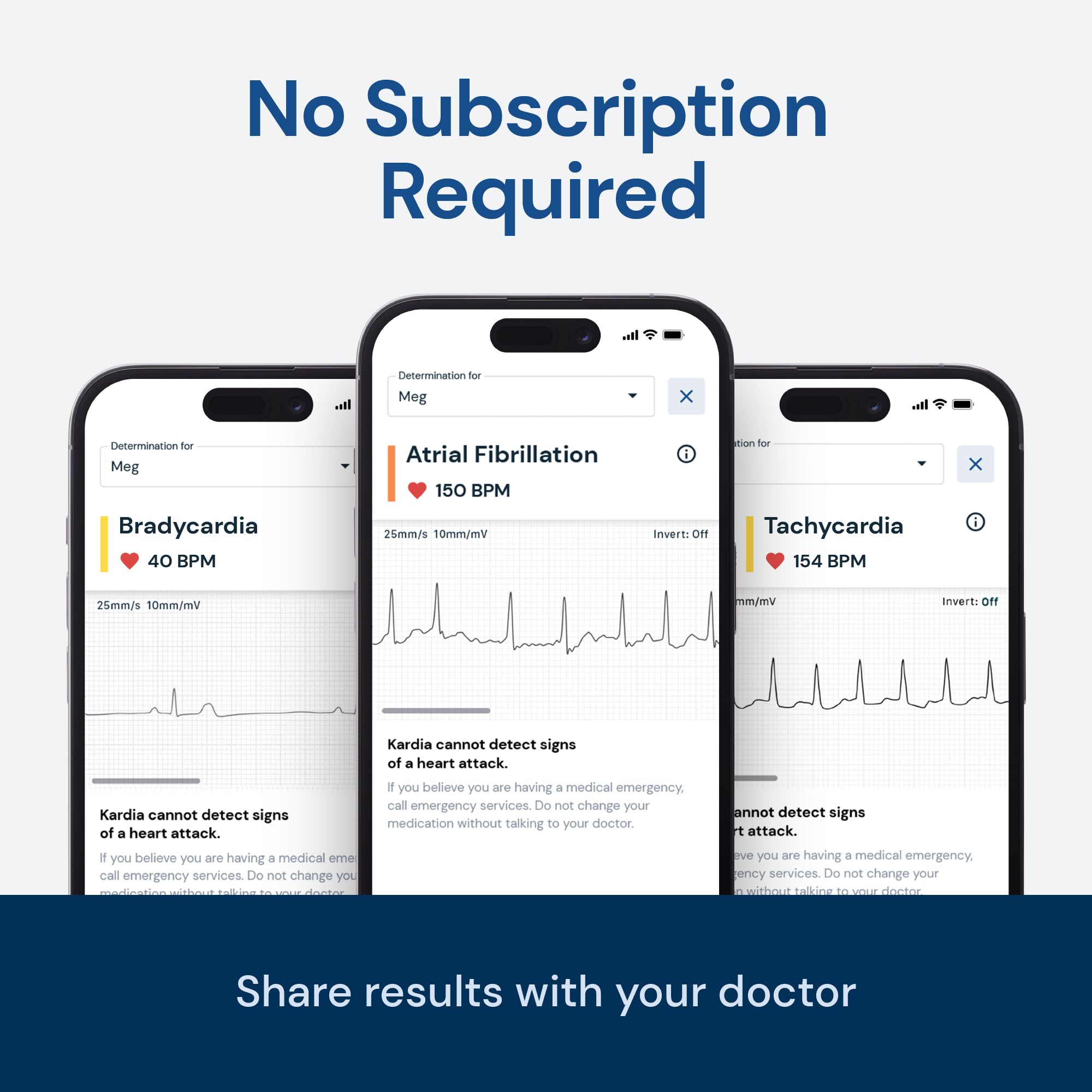 Personal EKG Monitor