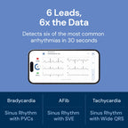 EKG Monitor