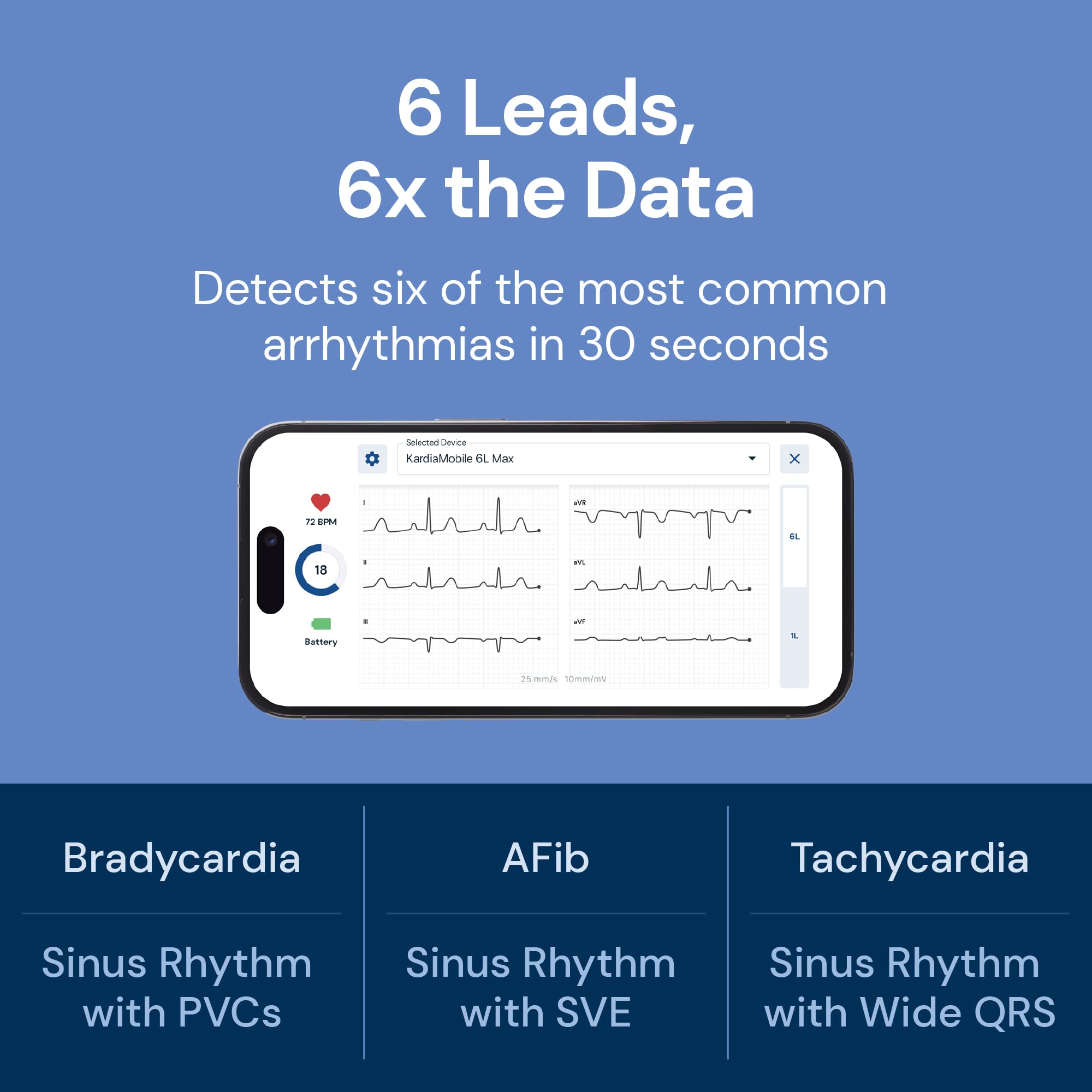 EKG Monitor
